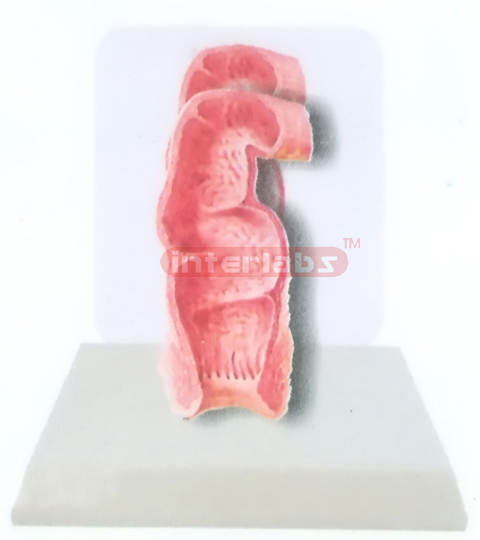 DESK-TYPE, HEALTH RECTUM MODEL WITH DESCRIPTION PLATE